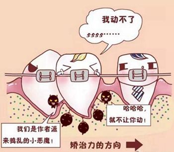 牙齿畸形做矫正要多少钱